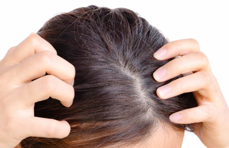 Quels sont les dangers de l’Aloe Vera pour les cheveux ?